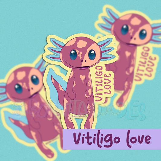 Vitiligo love- Axolotl vinyl sticker
